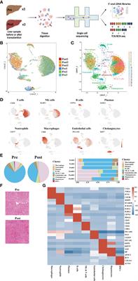 Single-cell RNA-seq revealing the immune features of donor liver during liver transplantation